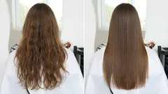 Wat is botox voor haar: hoe de behandeling werkt, voor wie deze geschikt is en de voor- en nadelen